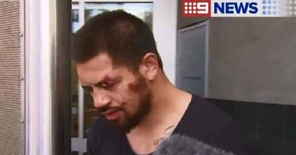 TOUCH UP: Douglas Menefata Asiata, of Springfield, leaves Brisbane Magistrates Court on Monday looking worse for wear. TOUCH UP: Douglas Menefata Asiata, of Springfield, leaves Brisbane Magistrates Court on Monday looking worse for wear.